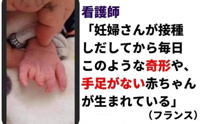 新型コロナワクチン後遺症 赤ちゃん