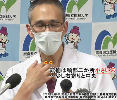 銃創は頸部2か所少し右寄りと中央