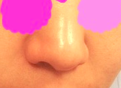 14)