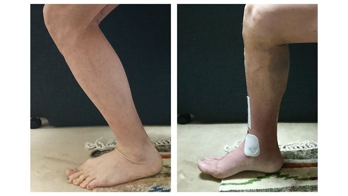 脛骨骨折から回復までの道のり トライアスロンとトレイルランニングに挑む５０代の独り言