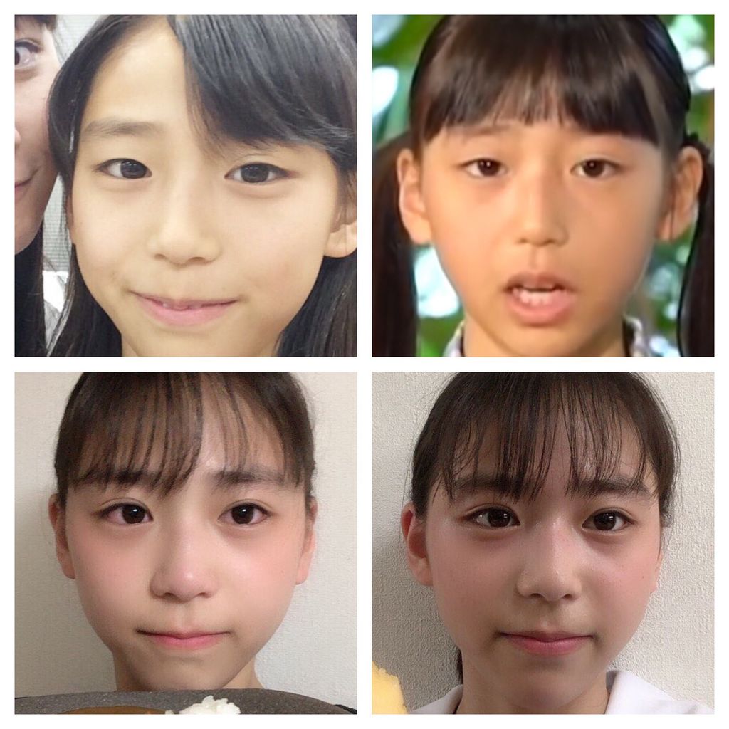 アンジュルム 橋迫鈴ちゃん 加入前にしっかり二重整形した件 しゅわぽく速報 アンジュルム 橋迫鈴ちゃん 加入前にしっかり二重整形した件 しゅわぽく速報