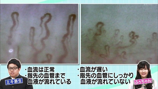 1493305446-0669-010