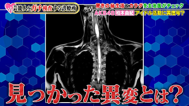 a2acd969