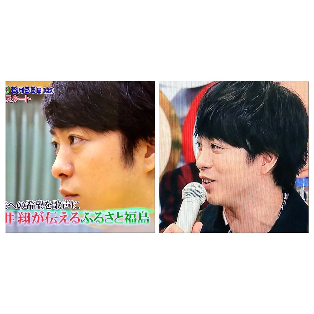 嵐 櫻井翔 紅白での顔が異様 目を整形 病気 などの噂も 画像あり Newsまとめもりー 2chまとめブログ