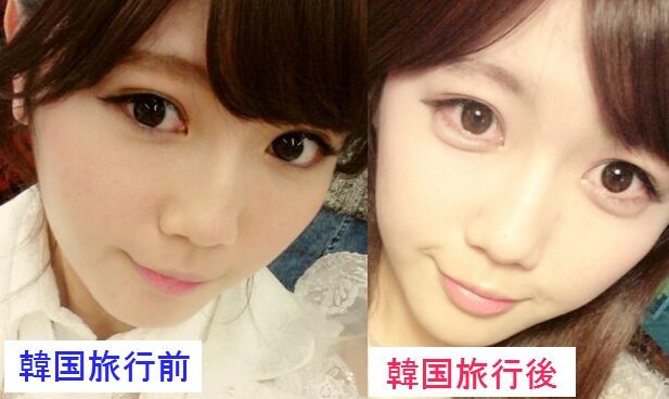 Akb宮崎美穂 文春でホストとお泊り熱愛スキャンダルｗｗ総選挙16の順位は78位で圏外から復活もまた終了へｗｗｗ 問題の画像あり Newsまとめもりー 2chまとめブログ