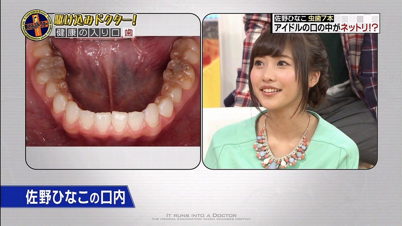 佐野ひなこの経験人数ｗｗｗ キス画像じゅんちむが元カレのたなしゅんガールズ一員 ヤングマガジンで水着グラビアデビューの大学生 2ch 歯茎 口元 卒アルが残念 動画 Newsまとめもりー 2chまとめブログ