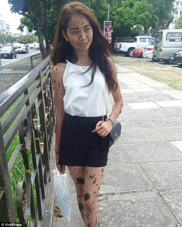 鳥肌注意 全身ホクロまみれの美少女 の写真 想像以上だった 画像あり Newsまとめもりー 2chまとめブログ