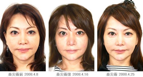 中村うさぎ 病気で再入院の現在がヤバイ 文春エッセイはクビ 医師の制止振り切り 5時に夢中 に生出演 顔整形前後比較画像あり Newsまとめもりー 2chまとめブログ