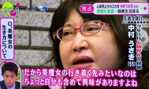 買い物依存 ホスト 整形そして 難病と心肺停止 生き急ぐ中村うさぎの現在地 ガールズちゃんねる Girls Channel