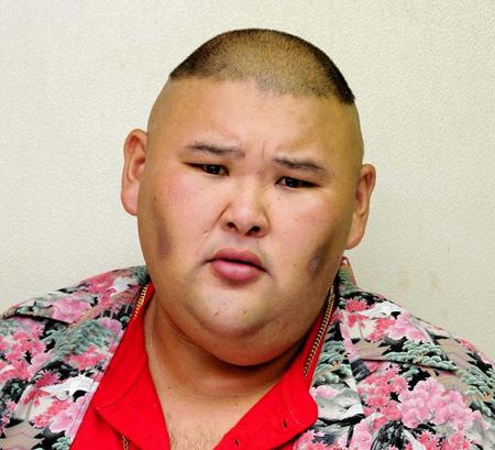 病気 安田大サーカスのhiro 激やせで変わり果てた姿になってしまう 画像あり Newsまとめもりー 2chまとめブログ