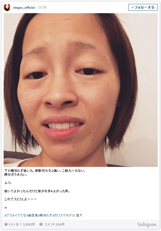 小森純のすっぴん現在画像がヤバイ メイクなしだと一重で顔がボラみたいなブスになってる件ｗｗｗ インスタ写真 Newsまとめもりー 2chまとめブログ