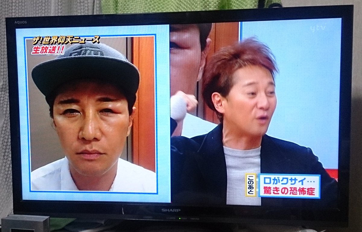 衝撃写真 中居正広の現在の顔がやばい 試合後の内藤大助みたいになってる 画像あり Newsまとめもりー 2chまとめブログ 衝撃写真 中居正広の現在の顔がやばい 試合後の内藤大助みたいになってる 画像あり Newsまとめもりー 2chまとめブログ