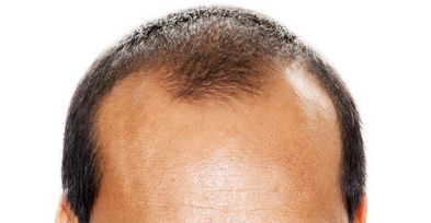 mjihage001
