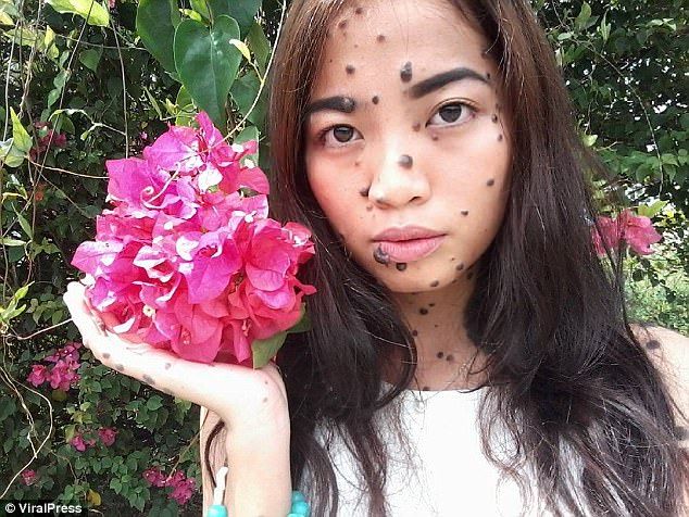 鳥肌注意 全身ホクロまみれの美少女 の写真 想像以上だった 画像あり Newsまとめもりー 2chまとめブログ