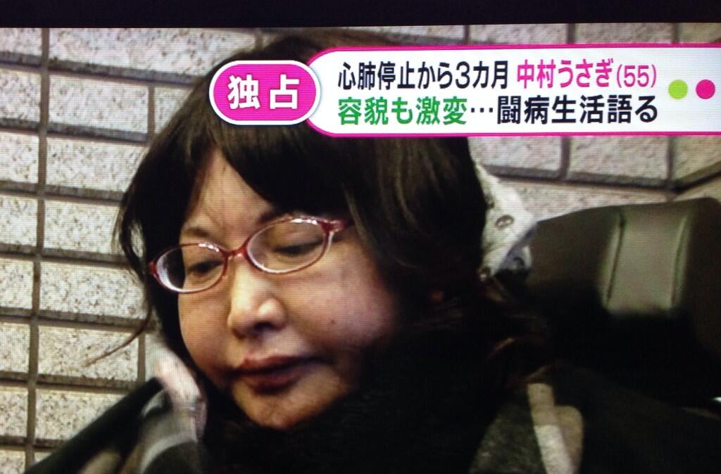 中村うさぎ 病気で再入院の現在がヤバイ 文春エッセイはクビ 医師の制止振り切り 5時に夢中 に生出演 顔整形前後比較画像あり Newsまとめもりー 2chまとめブログ
