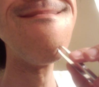 衝撃 あごひげを6年間抜き続けた結果ｗｗｗｗｗｗ 画像うｐあり Newsまとめもりー 2chまとめブログ