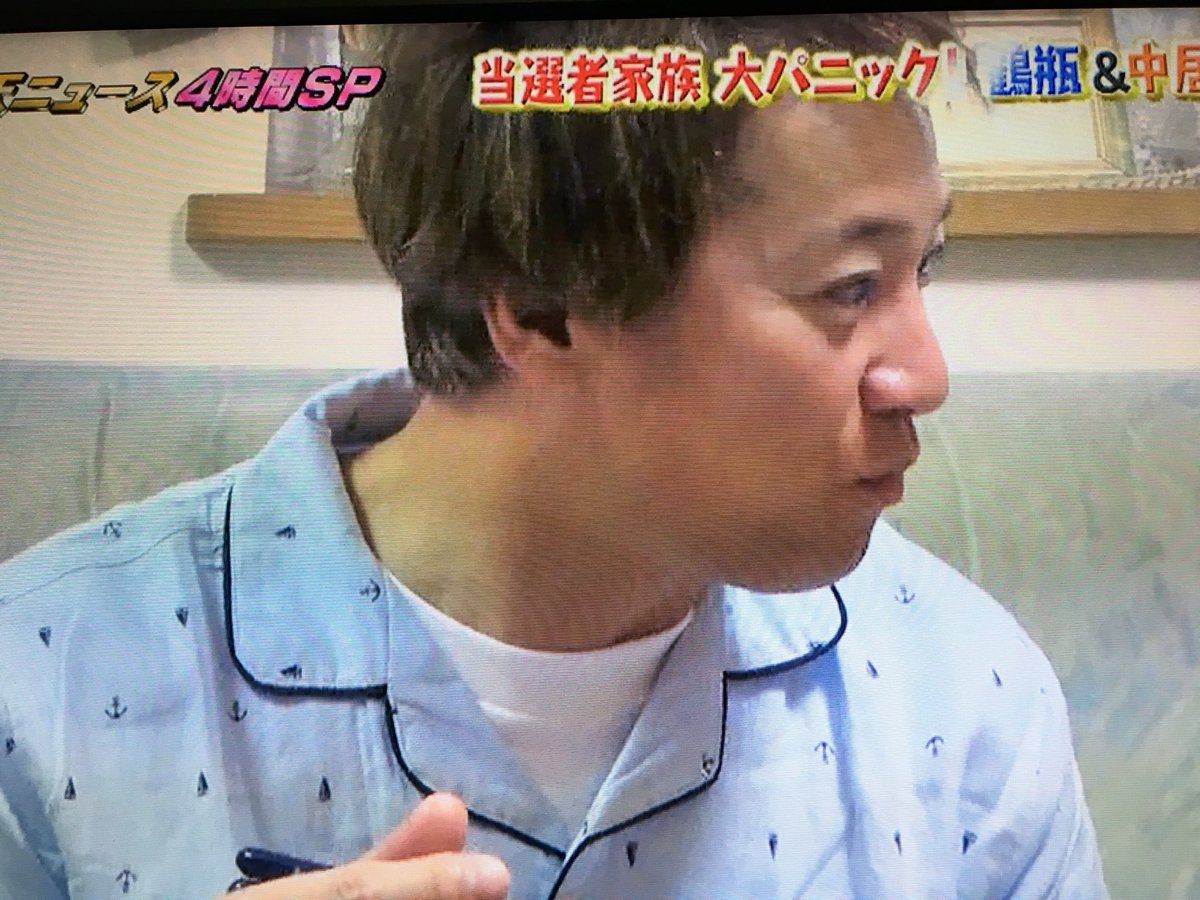髪の毛 中居正広が放送事故wwwwwwww 画像あり Newsまとめもりー 2chまとめブログ 髪の毛 中居正広が放送事故wwwwwwww 画像あり Newsまとめもりー 2chまとめブログ