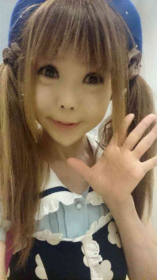 愕然 二重涙袋ありなしでここまで差あるのなｗｗｗｗｗ 画像あり Newsまとめもりー 2chまとめブログ