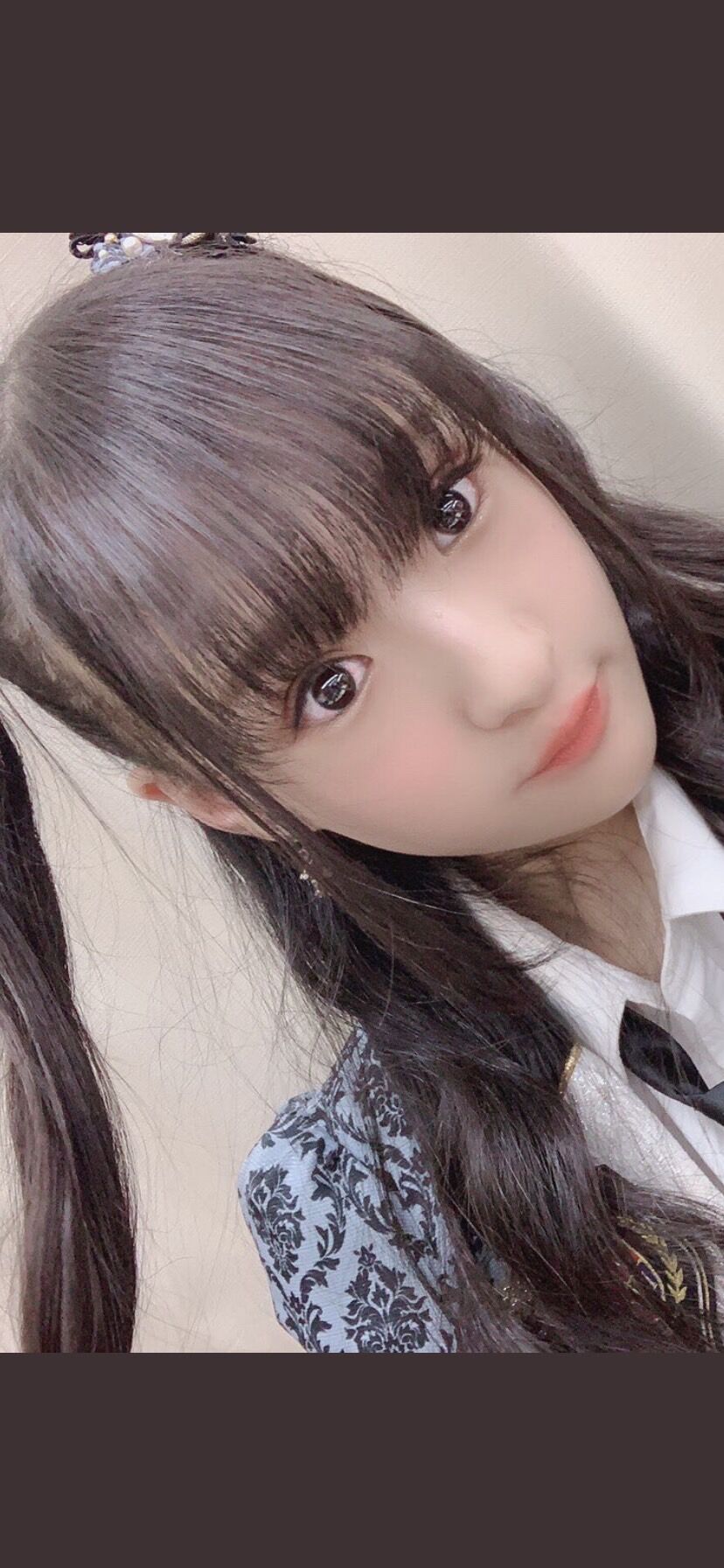 Nmb48 インフルエンザのため休演 実は整形してましたーｗｗｗｗｗｗ Akbフレンド