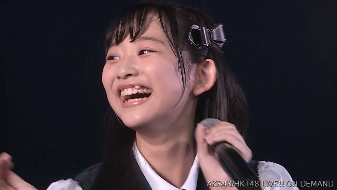 速報 過剰歯で話題になったhkt馬場彩華c矯正を始める Akbフレンド 速報 過剰歯で話題になったhkt馬場彩華c矯正を始める Akbフレンド