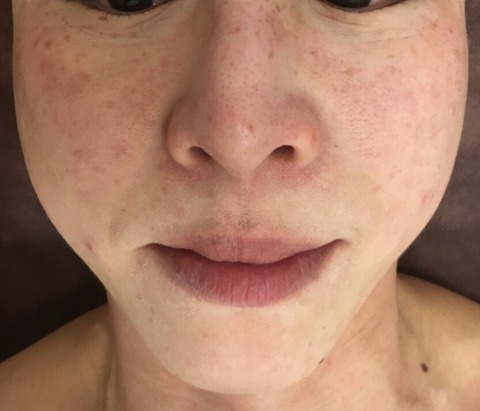 IMG_20170405_100102[195]mae