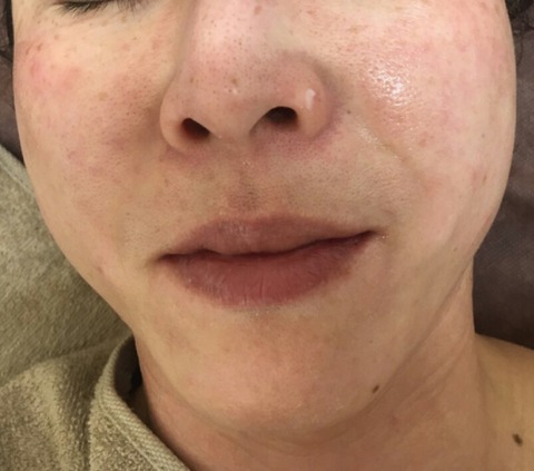 IMG_20170405_100249[197]mae