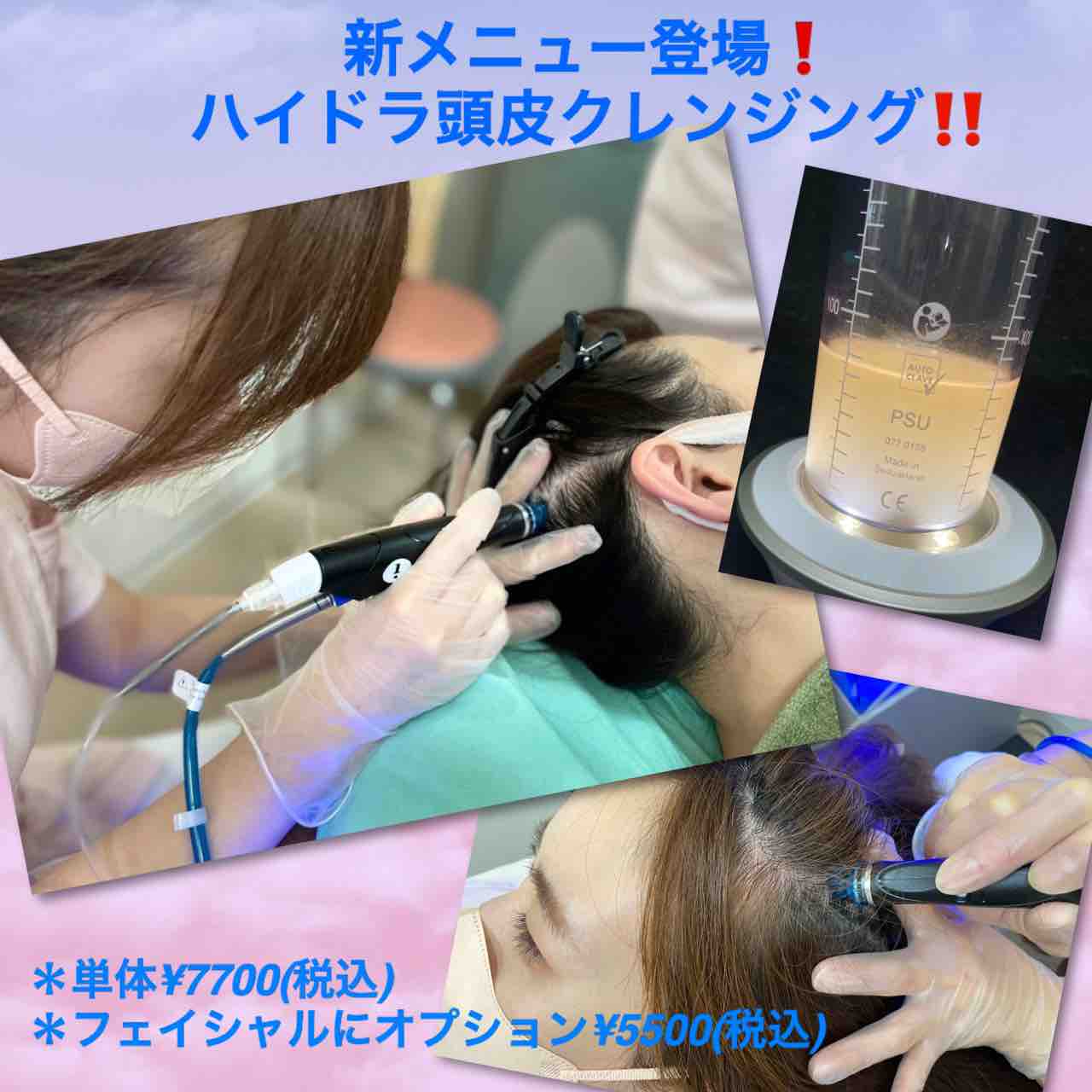 新メニュー🆕ハイドラ頭皮クレンジング💆🏻‍♀️ : あけみ皮フ科
