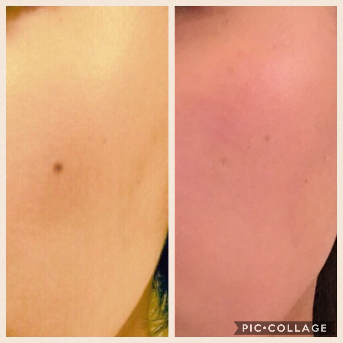 債務者 キャビン 懲らしめ スポッツ カバー ファンデーション ほくろ K Kacchan Jp