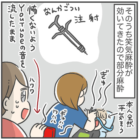 230703_過剰歯05_01