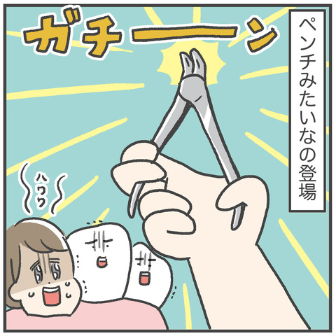 230703_過剰歯05_04
