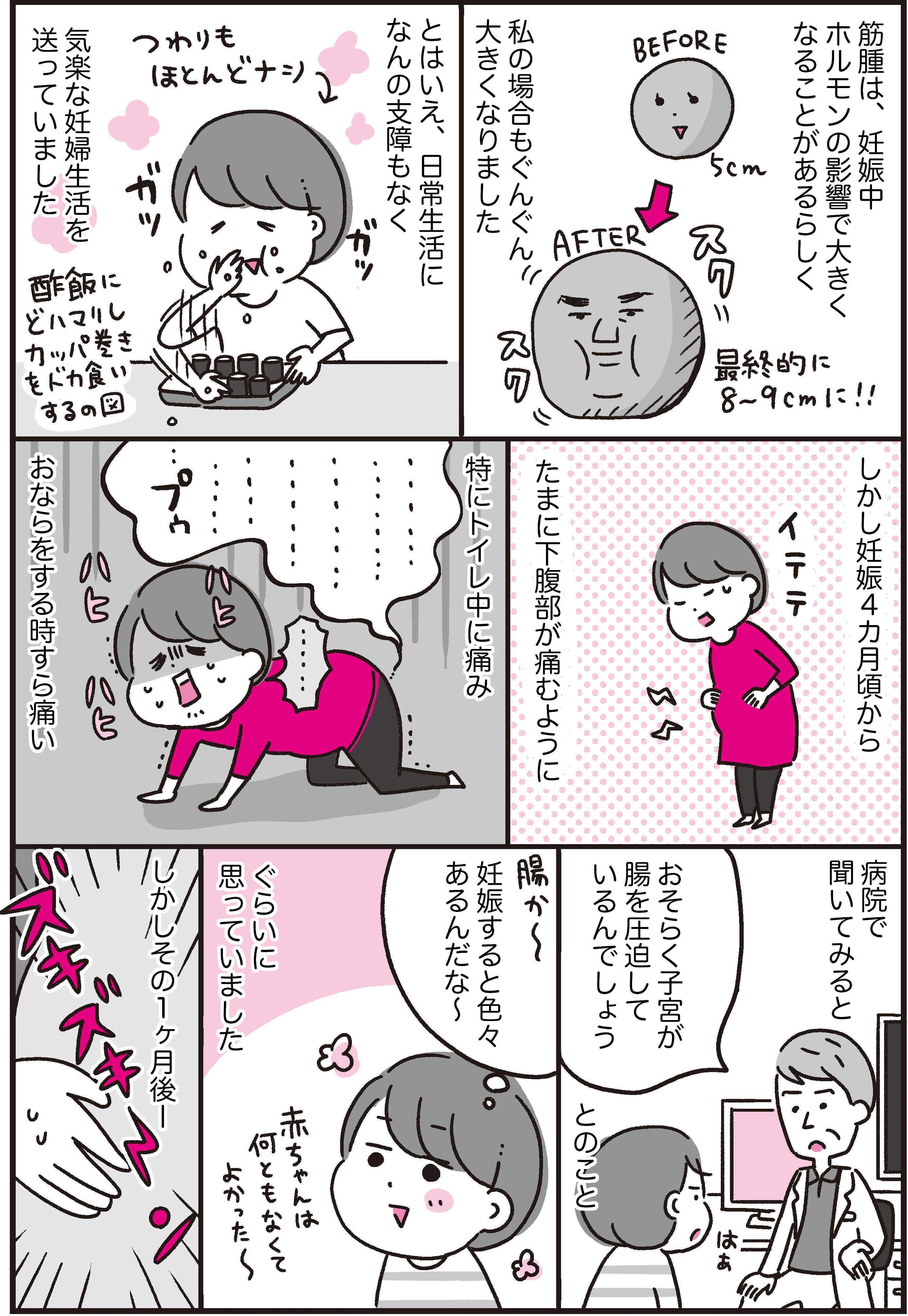 子宮筋腫合併妊娠で入院した話 1 3 あきばさやかの人生ケアレスミス Powered By ライブドアブログ 子宮筋腫合併妊娠で入院した話 1 3 あきばさやかの人生ケアレスミス Powered By ライブドアブログ