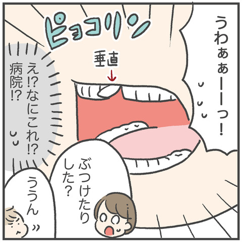230324_おっくん乳歯01_02