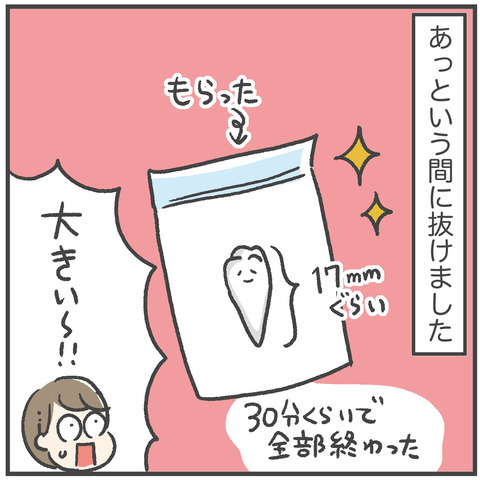 230703_過剰歯05_06