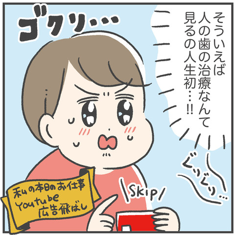 230703_過剰歯05_02