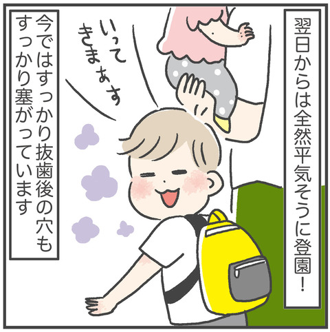 230706_過剰歯06_05