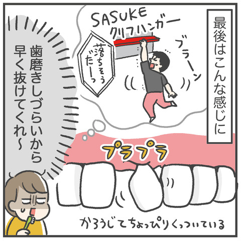230324_おっくん乳歯01_06