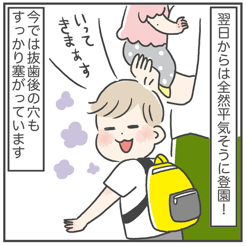 230706_過剰歯06_05