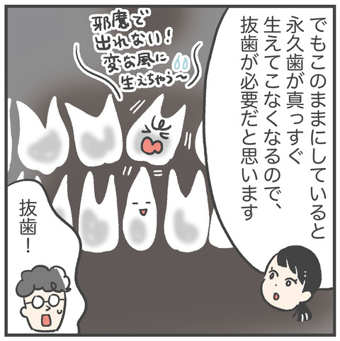 230621_過剰歯02_03