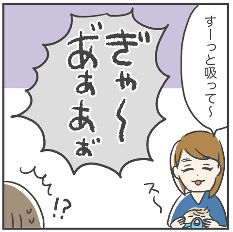 230628_過剰歯04_04
