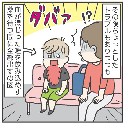 230706_過剰歯06_04