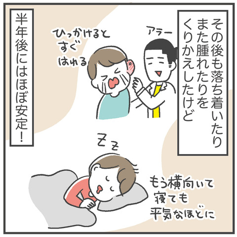 240706_軟骨ピアス03_01