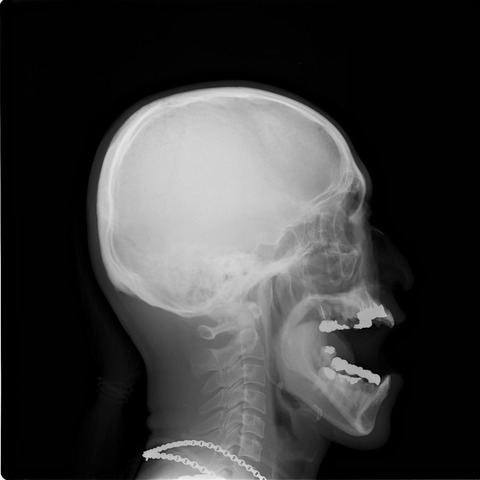 20100907211358109001