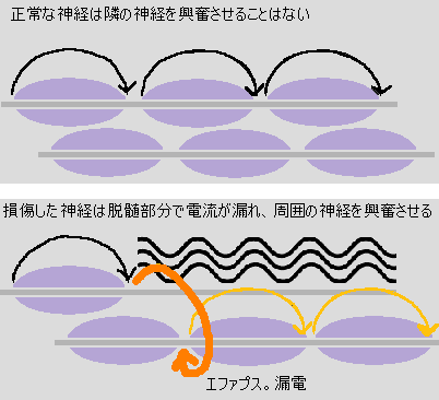 神経が傷つくということ きゃばりこ記
