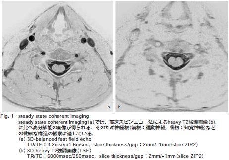 きゃばりこ記 mri
