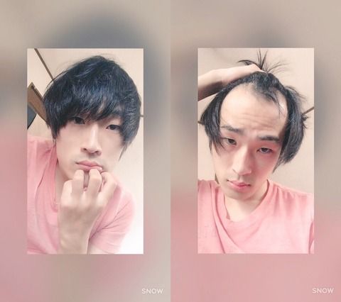 こんな感じで後ろから髪持ってきてハゲ隠してる奴ｗｗｗｗｗｗｗｗｗｗｗｗｗｗｗｗｗｗｗｗｗｗ