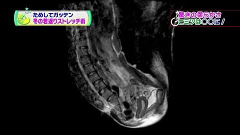 09848ab4-s