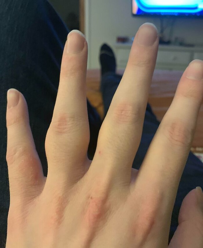 63078e1d8ecfc_unique-people-rare-genetics (1)