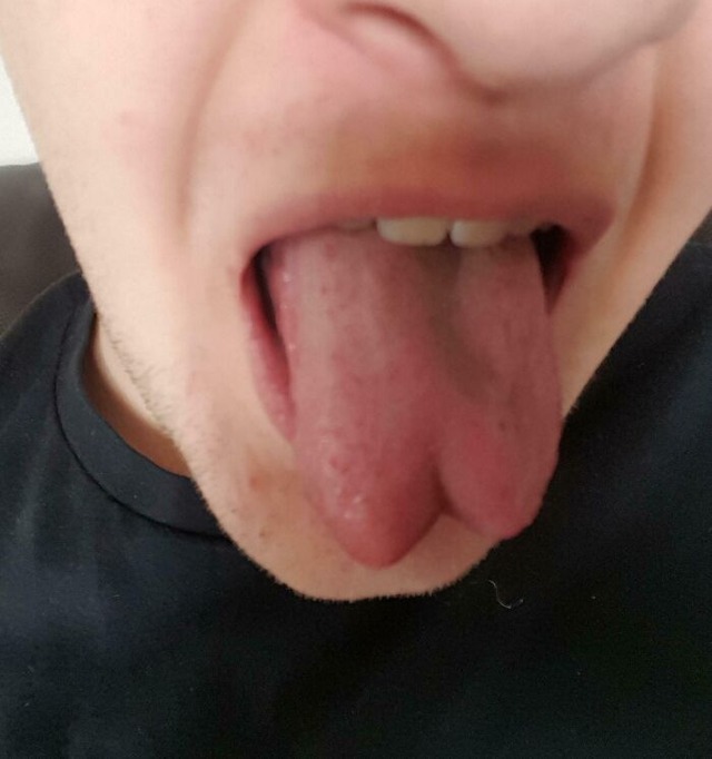 68a430afae614_fascinating-images-of-the-human-body__700