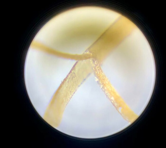 6849694ac247f_interesting-microscope-pictures