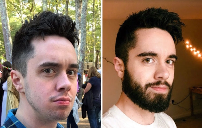 before-after-beard-growing-pics-1-6449289368a0a__700